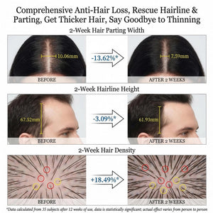 Hair Fall Reduction Shampoo 350ml | Anti-Hair Loss Scalp
