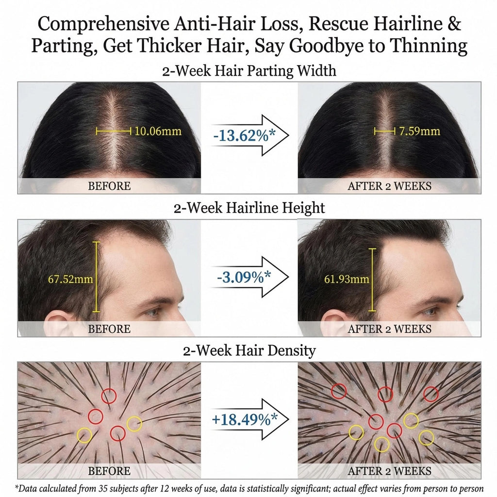 Hair Fall Reduction Shampoo 350ml | Anti-Hair Loss Scalp