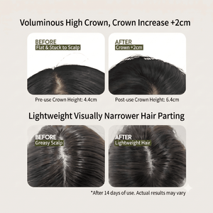 HONLINK Leave-in Dry Shampoo Gel for Oily Scalp | 5s Instant Oil Absorption & +2cm Voluminous High Crown | Waterless Hair Fluffy Dew, No-Rinse & Fast-Drying Sebum Control, Travel Size - HONLINK