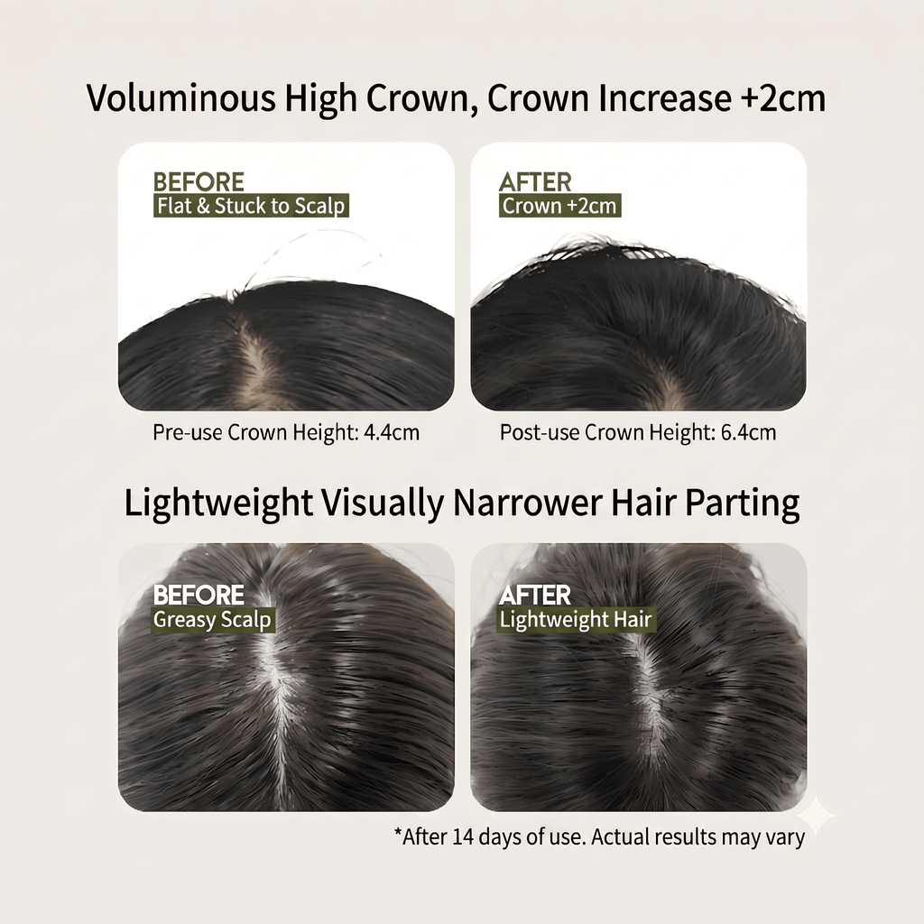 HONLINK Leave-in Dry Shampoo Gel for Oily Scalp | 5s Instant Oil Absorption & +2cm Voluminous High Crown | Waterless Hair Fluffy Dew, No-Rinse & Fast-Drying Sebum Control, Travel Size - HONLINK
