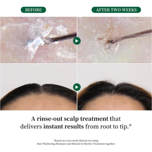 Rosemary Scalp Tonic for Hair Growth - with Ginseng & Caffeine - Revitalizing Hair Treatment for Hair Thinning & Hair Loss - HONLINK