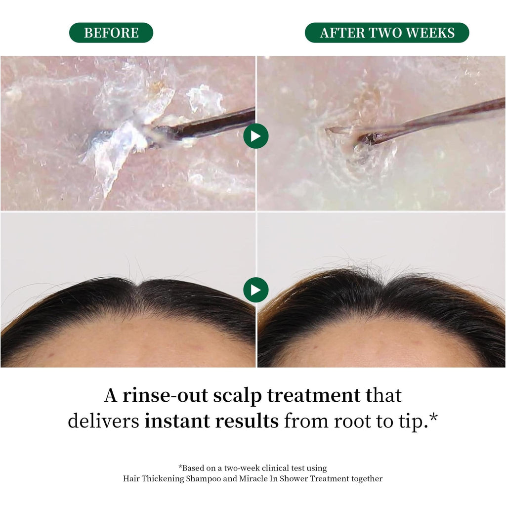 Rosemary Scalp Tonic for Hair Growth - with Ginseng & Caffeine - Revitalizing Hair Treatment for Hair Thinning & Hair Loss - HONLINK