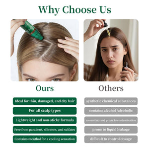 Winning Hair Thickening Serum for Hair Loss, Hair Care, Scalp Treatment, Clinically Tested, Reduces Oil - HONLINK